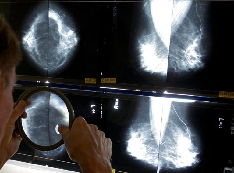 Sask. to open Breast Health Centre, expand screening age
