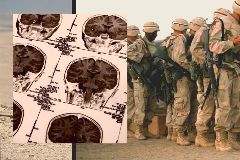 A Navy SEAL was convinced exposure to blasts damaged his brain, so he donated it to science to prove it
