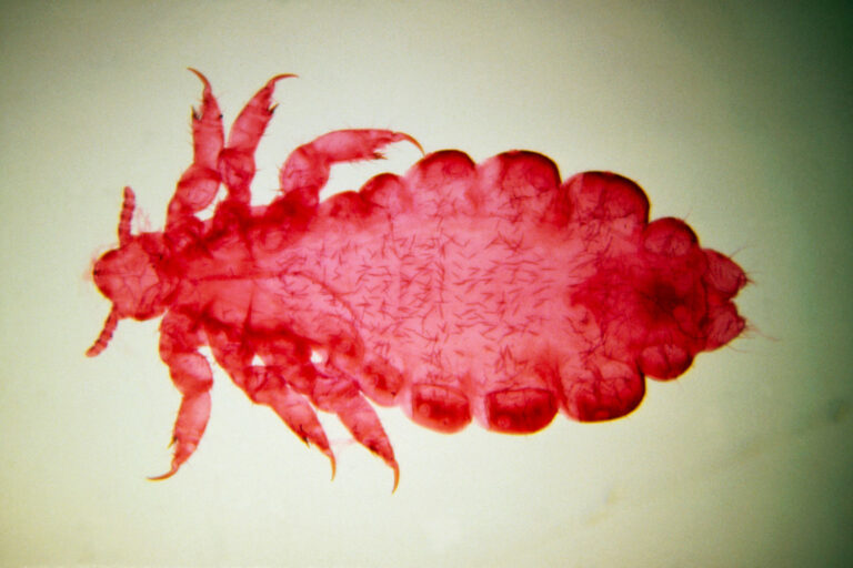 Blood-sucking body lice may have spread plague more than thought, science suggests