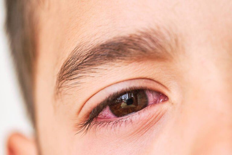 Most kids get antibiotics for pink eye. Experts say they're not needed.